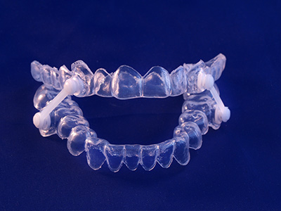 Dream Dental Group | Ceramic Crowns, Dental Fillings and Sleep Apnea