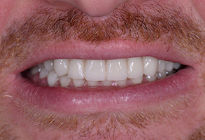Dream Dental Group | Cosmetic Dentistry, Veneers and Oral Appliance Therapy