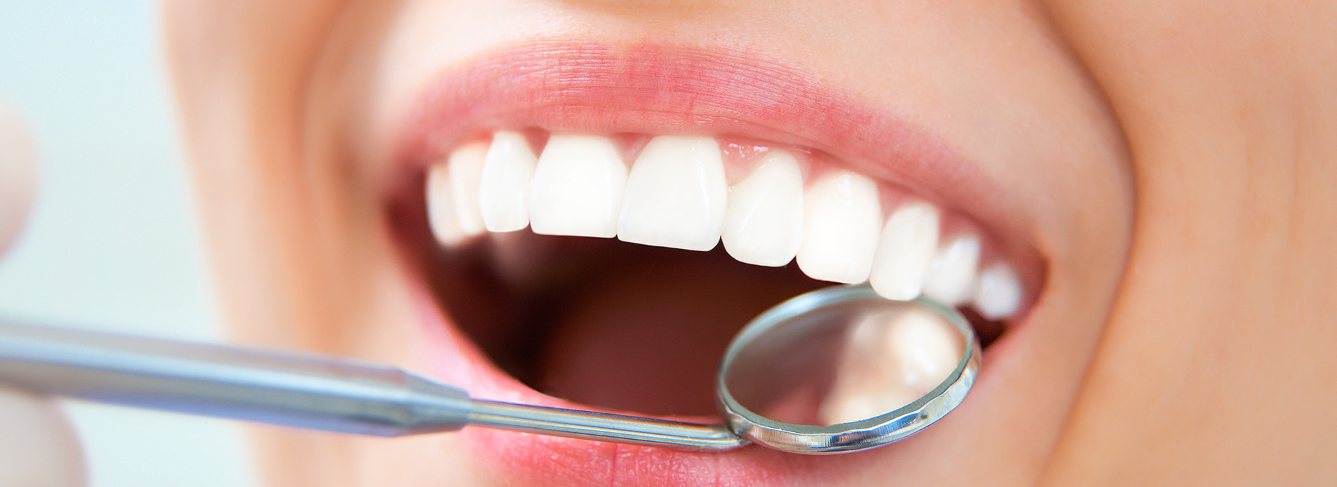 Dream Dental Group | Inlays amp Onlays, Dental Bonding and Full Mouth Reconstruction