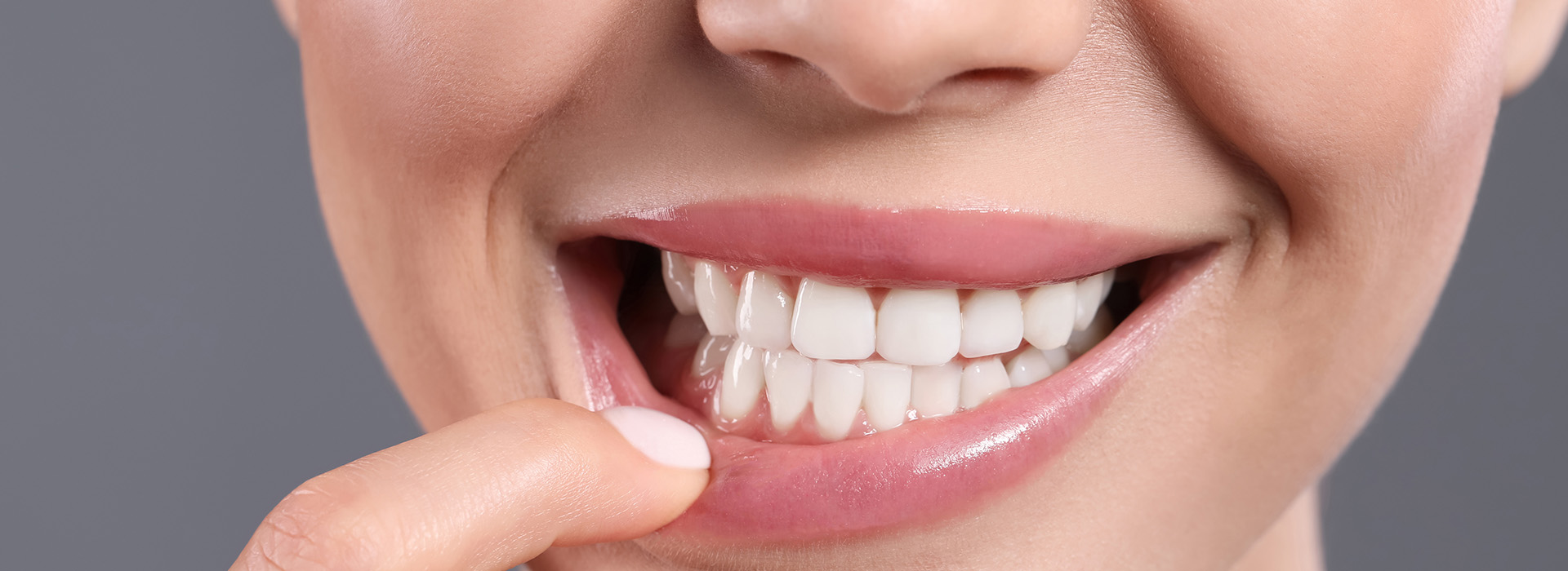 Dream Dental Group | Inlays  amp  Onlays, Fluoride Treatment and Night Guards