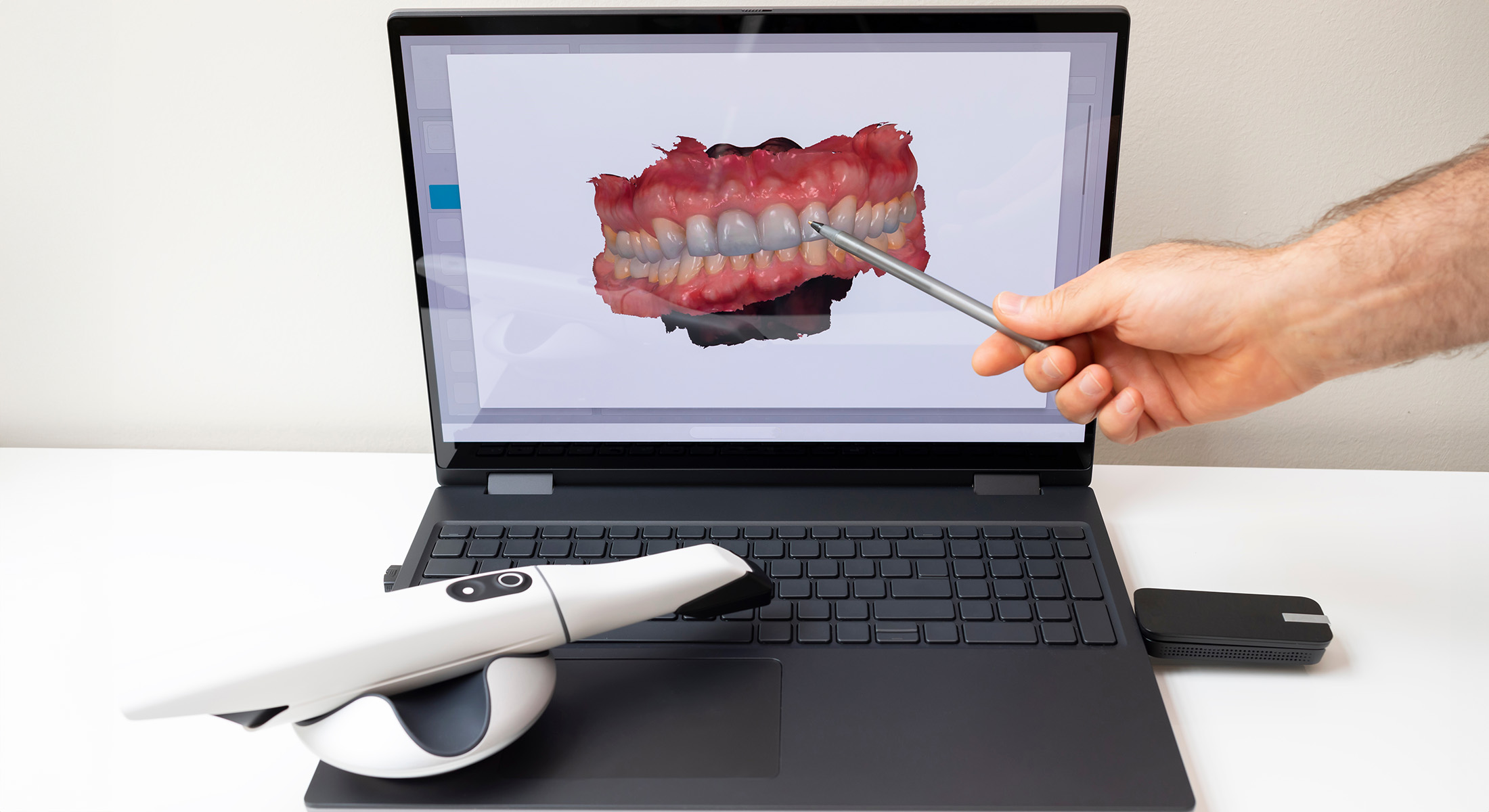 Dream Dental Group | Inlays & Onlays, Dental Cleanings and Dental Bonding