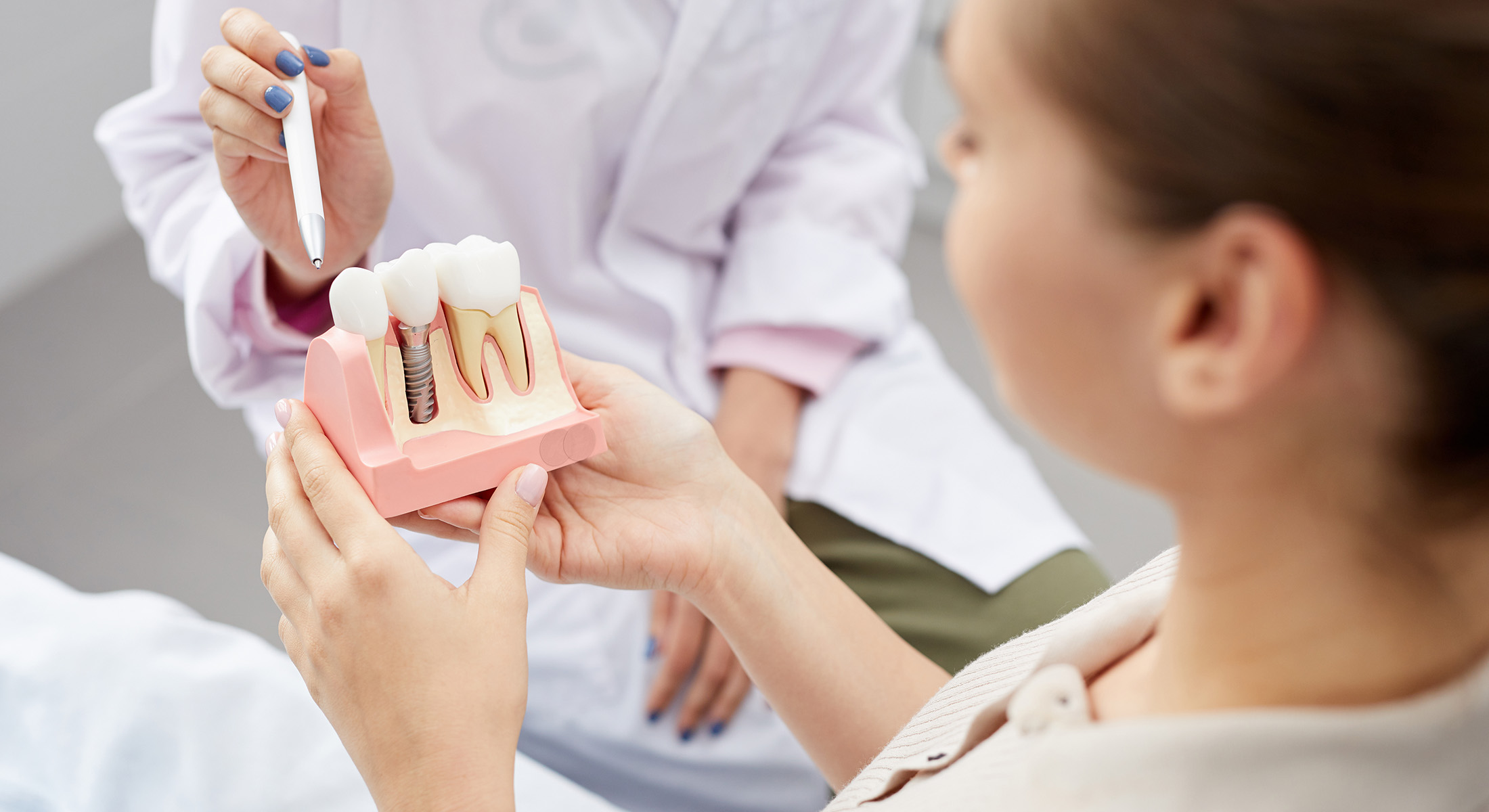 Dream Dental Group | Implant Dentistry, Fluoride Treatment and Snoring Appliances