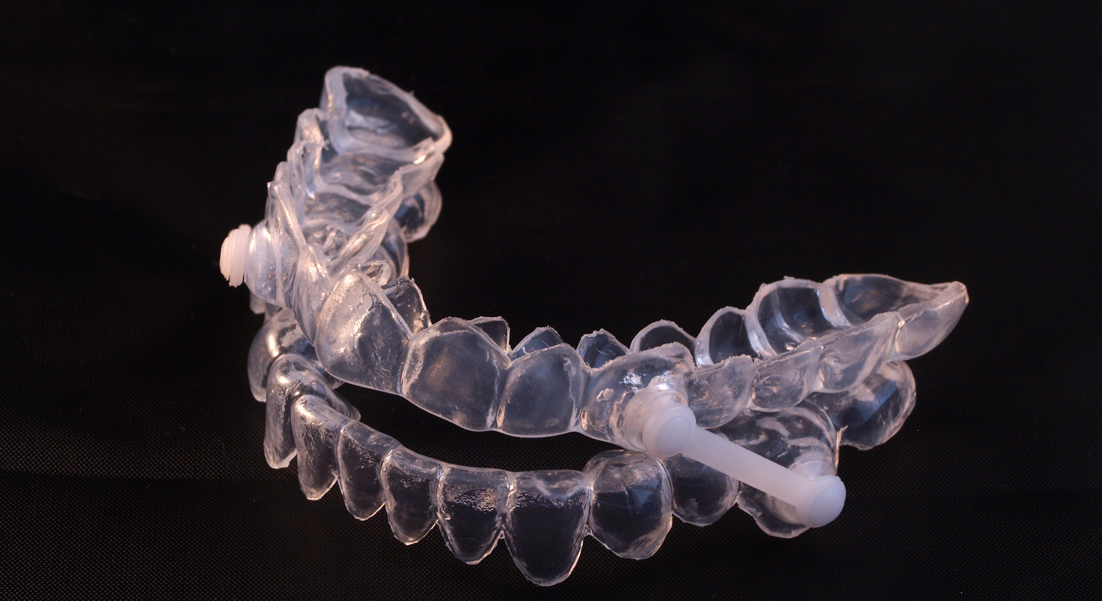 Dream Dental Group | Snoring Appliances, Curodont and Periodontal Treatment