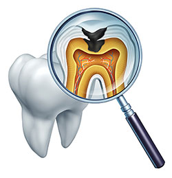 Dream Dental Group | Dental Cleanings, Veneers and Oral Exams
