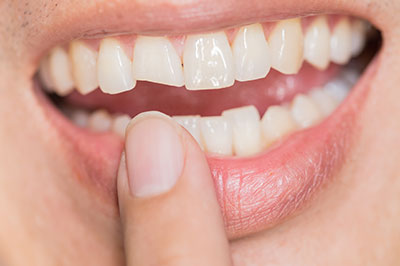 Dream Dental Group | Dental Cleanings, Emergency Treatment and Night Guards