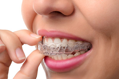 Dream Dental Group | Root Canals, Dentures and Veneers