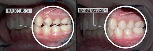 Dream Dental Group | Retained Dentures, Oral Exams and Snoring Appliances