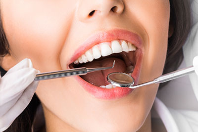 Dream Dental Group | Dental Sealants, Dental Fillings and Ceramic Crowns