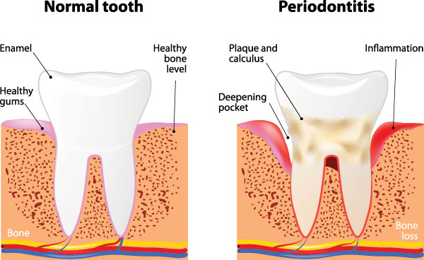 Dream Dental Group | Periodontal Surgery, TMJ Disorders and Snoring Appliances