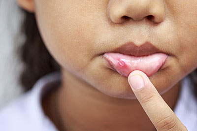Dream Dental Group | Dentures, Bone Grafts and Pediatric Dentistry