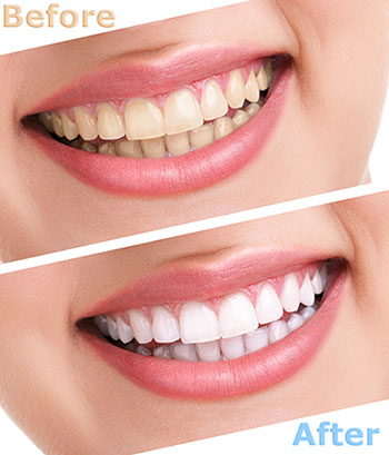 Dream Dental Group | Cosmetic Dentistry, Dental Cleanings and Dental Fillings