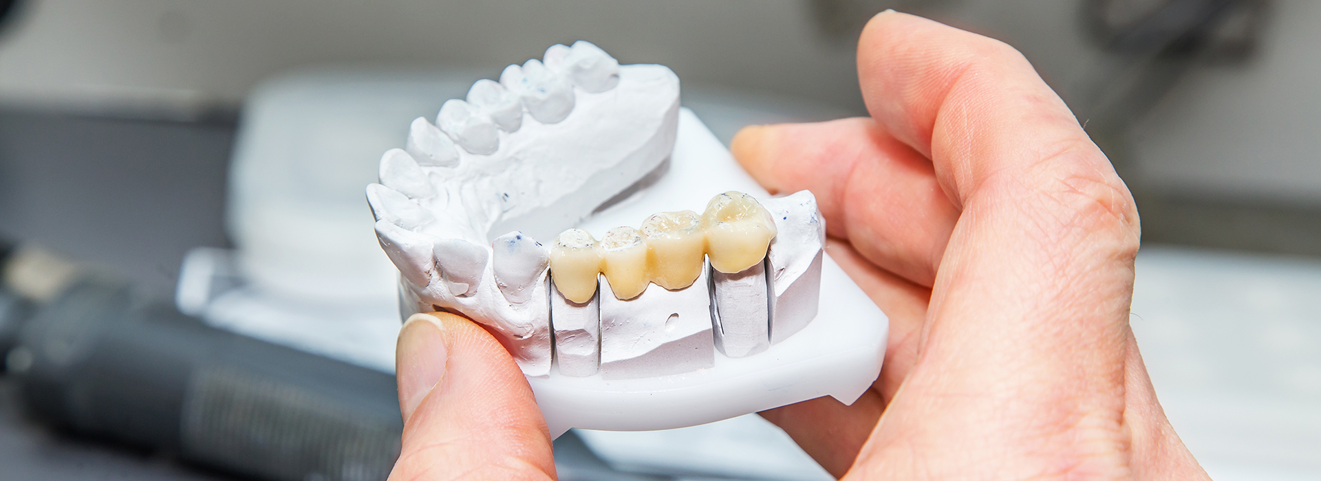 Dream Dental Group | Sleep Apnea, Dental Fillings and Dental Bonding