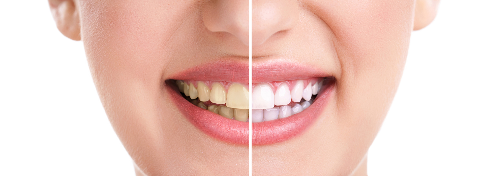 Dream Dental Group | Full Mouth Reconstruction, Extractions and Sleep Apnea