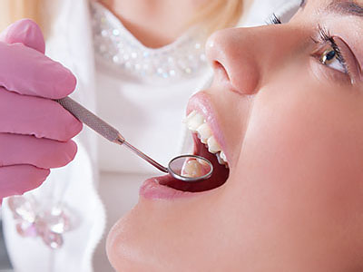 Dream Dental Group | Bone Grafts, Root Canals and Teeth Whitening