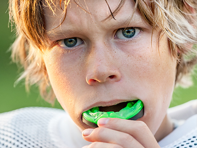 Dream Dental Group | Implant Dentistry, Inlays  amp  Onlays and Sports Mouthguards